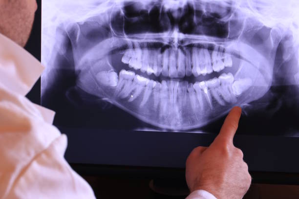 Best Tooth Infection Emergency Dentist  in Suamico, WI