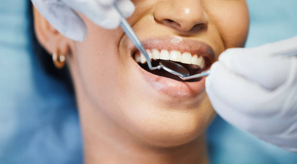 Best Chipped Tooth Repair Near Me  in Suamico, WI